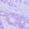 Multiplex in-situ RNA detection