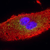 Multiplex in-situ RNA detection