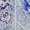 Multiplex in-situ RNA detection