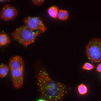 Multiplex in-situ RNA detection